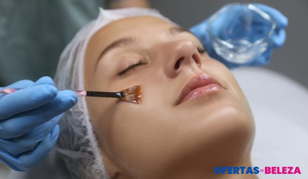 O que é peeling e como funciona