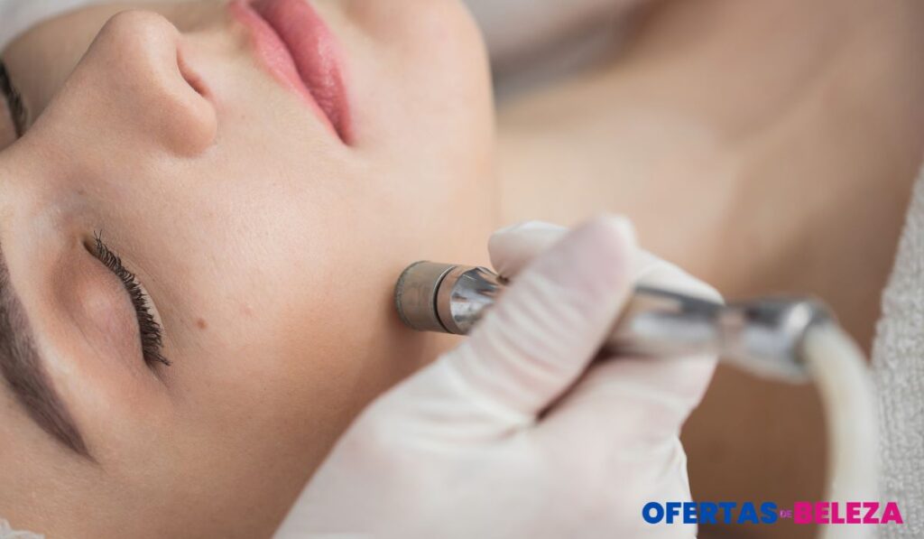 Perguntas frequentes sobre peeling